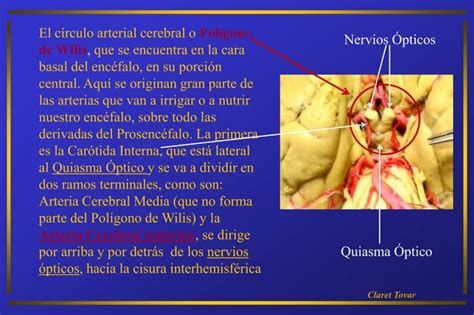 6 Tarea Neurociencia Las Meninges e Irrigación del Cerebro PPT