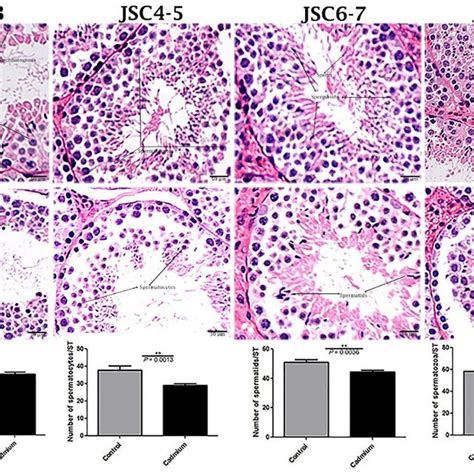 Light Microscopy Of Seminiferous Tubules Of Testis Of Control A And