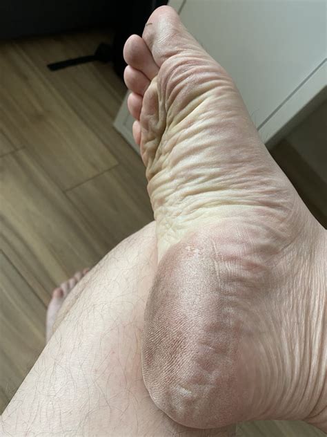 My Close Up Feet And Soles Pics Xhamster