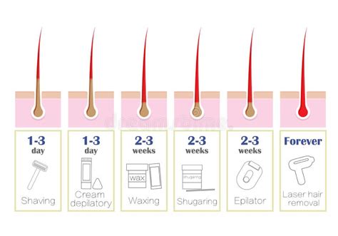 26 Laser Hair Removal Vs Waxing Allysonconlan
