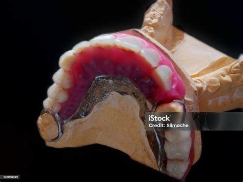 Prosthetics Manufactured And Unfinished Isolated In A Black Background