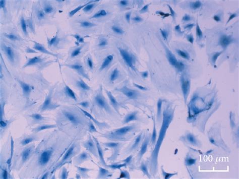 Osteoblast Morphology Of A C And E The Control Group And B D And