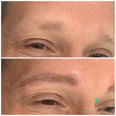 Microblading For Men Gallery Cosmetic Tattoo Clinic Manchester