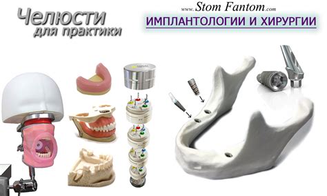 Модели челюстей для установки Имплантантов и Хирургических вмешательств