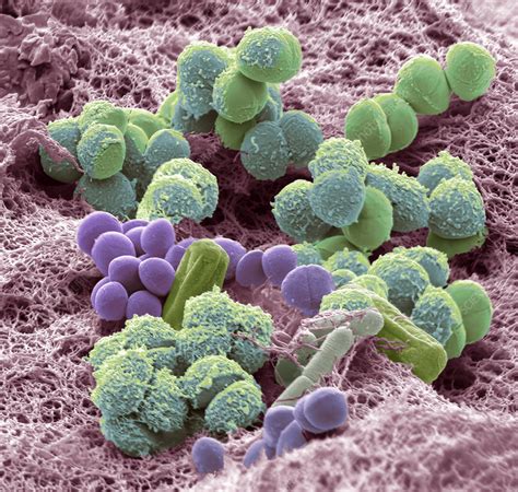 bacteria   train door handle sem stock image