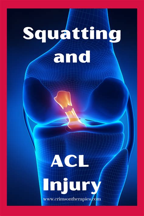 Acl Injury Artofit