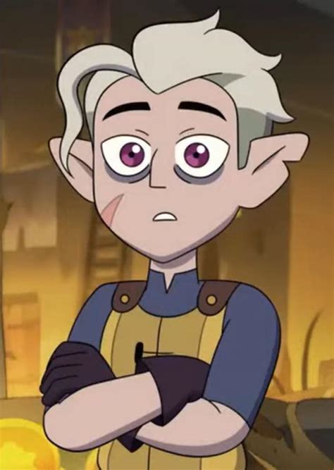 random question about hunter: are his scars from when he was younger ...