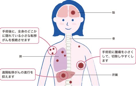 薬物療法｜乳がんの治療｜おしえて 乳がんのコト【中外製薬】