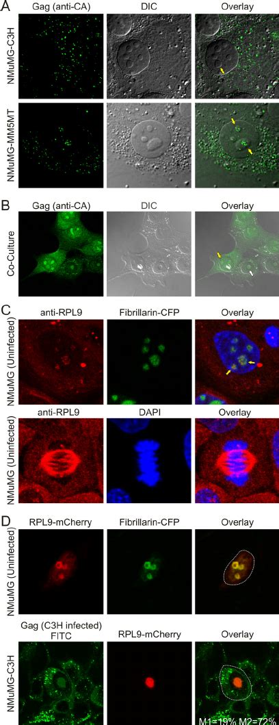 Localization Of MMTV Gag And L9 In Mouse Mammary Cells A