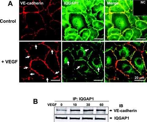 IQGAP1 Mediates VE CadherinBased CellCell Contacts And VEGF Signaling