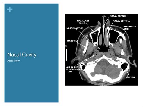 Nasal Cavity And Paranasal Sinuses Radiologic Anatomy Ppt