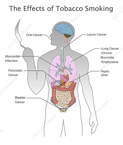 Effects Of Smoking On The Human Body