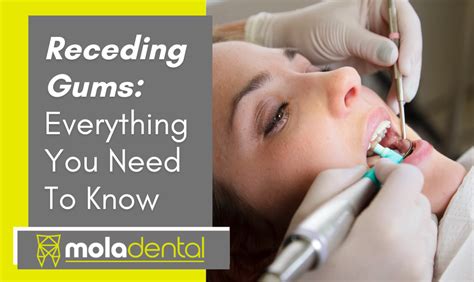 Receding Gums Everything You Need To Know