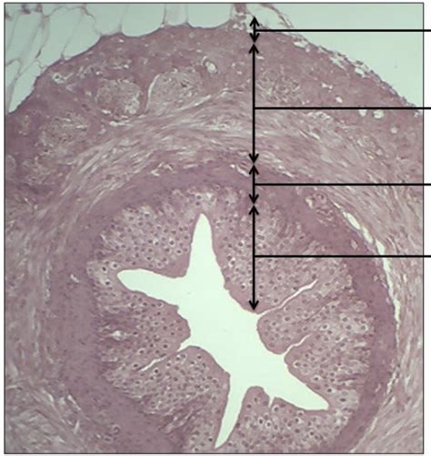 ureter histology Diagram | Quizlet