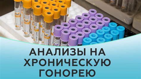 Мазок на гонорею: сколько делается анализ, методы диагностики и ...