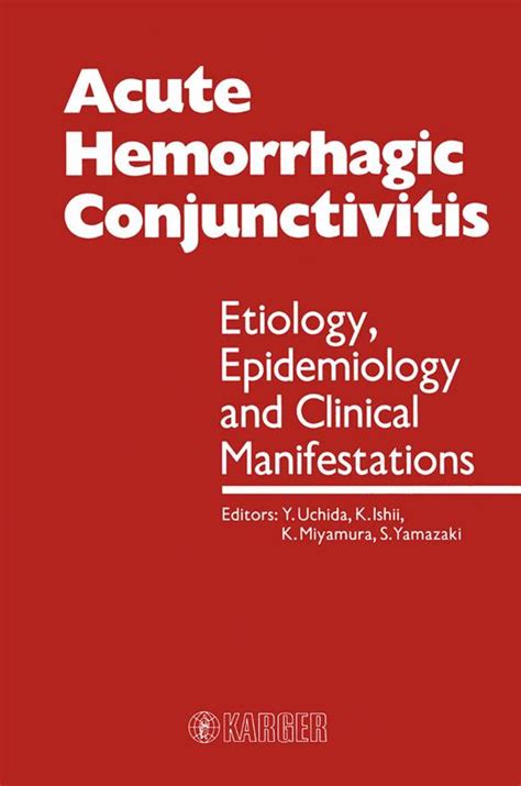 Acute Hemorrhagic Conjunctivitis In Malaysia 197085 Acute
