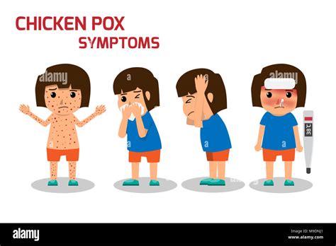 Children Has Chicken Pox Infographic Poster Children Fever And