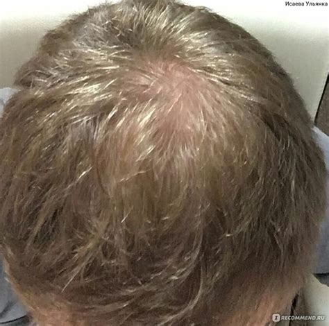 Лосьон для роста волос Adam Laurier с розмарином - «На макушке стало ...