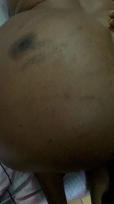 Nasty Bbw Raw Anal Xxx Video At Xnxx Org Porn Tube