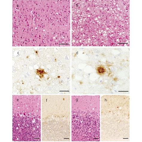 Histology And Immunohistochemistry IHC Of PrP Sc In The Brains Of