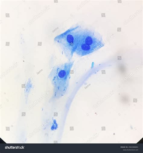 Ziehl Neelsen Stain Procedure 4