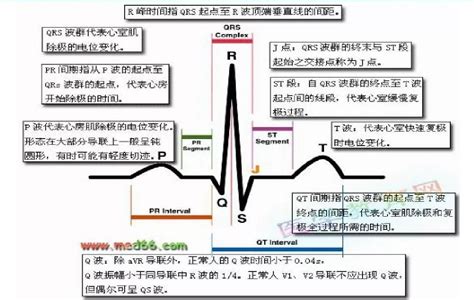 心电图小白必看：如何快速判断心电图？心电图p波间期波群复极 健康界