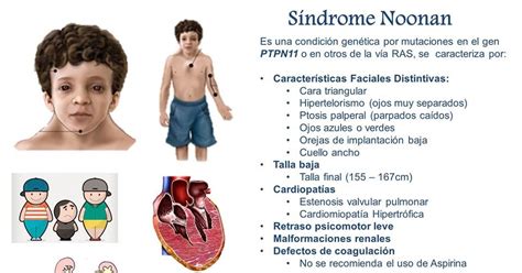 Gen Tica B Sica Pruebas De Diagn Stico Para El S Ndrome De Noonan