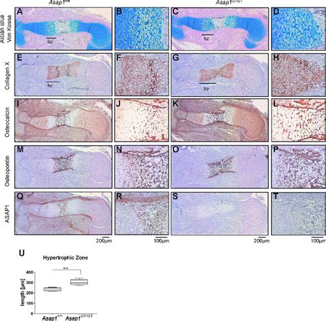 Loss Of ASAP1 Results In Expansion Of The Hypertrophic Zone A D