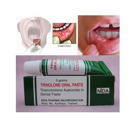 Jual Obat Sariawan Trinolone Oral Paste Bangkok Kab Deli Serdang