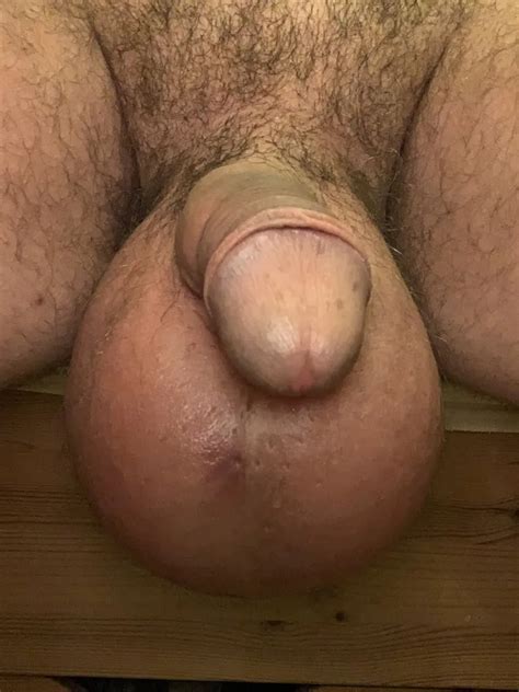 Glucose Prozent Nude Pics Xhamster