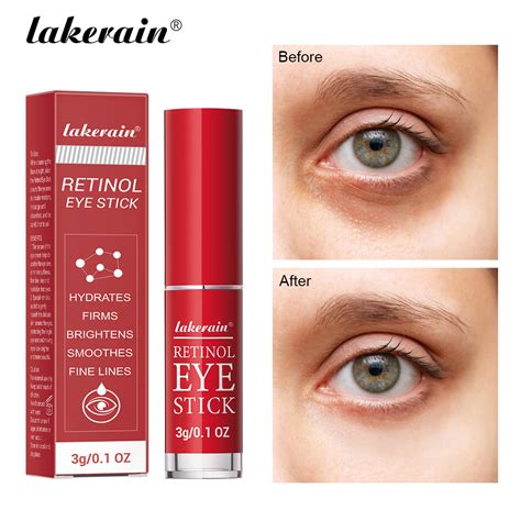 Creme Para Area Dos Olhos Com Retinol - Novo Creme para Área dos Olhos com Retinol 3g: Remove Bolsas sob os ...