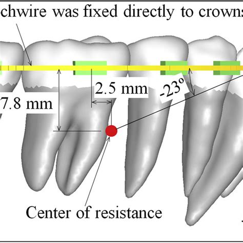 Pdf Biomechanical Analysis Of Total Mesialization Of The Mandibular