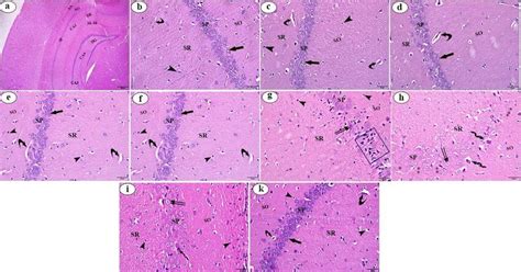 Photomicrographs hippocampal sections (a) to (K) stained with H&E ... 