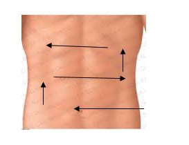 Pyloromyotomy Scar