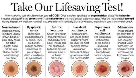 Skin Cancer Moles Chart