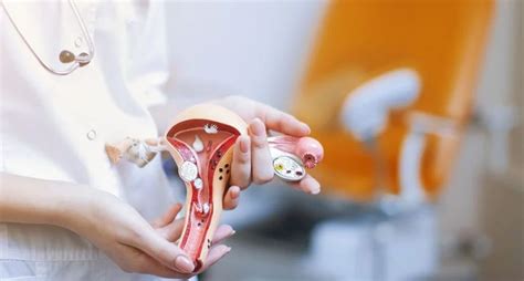 Причины молочницы: от чего появляется заболевание, причины ...