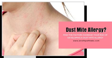 Say Goodbye To Dust Mites Now Unlock The Secret To Allergy Free Living