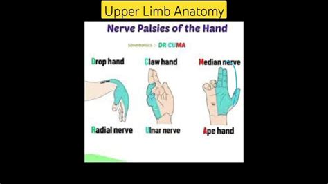 Wrist Drop Claw Hand Ape Hand Anatomy Upper Limb Nerve Clinical Youtube