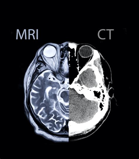 CT・MRI ー各々の役割ー | 脳疾患を知る | 桑名眼科脳神経クリニック