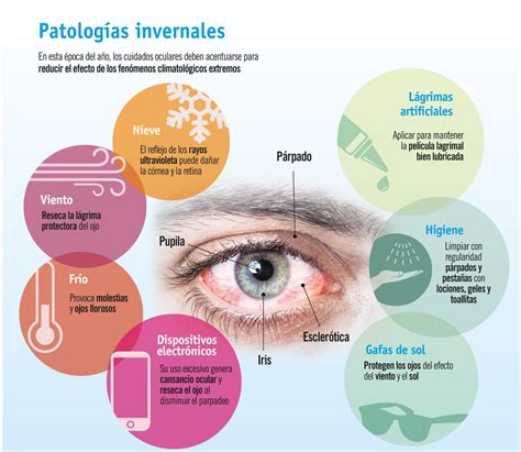 El síndrome del ojo seco Todo lo que debes saber