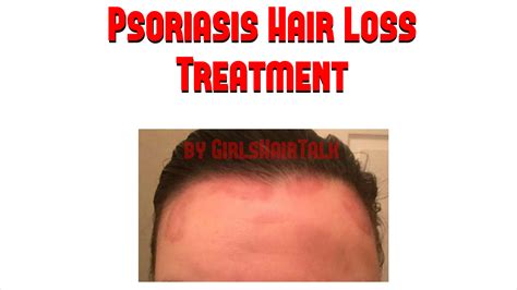 Psoriasis And Hair Loss Spefashion