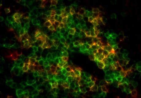 Anti-CD3 antibody (ab5690) | Abcam