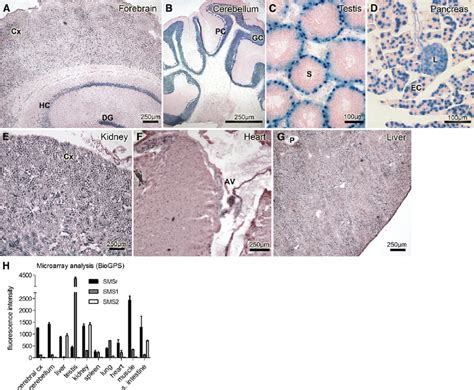 Mouse Smsr Is A Ubiquitously Expressed Gene ␤ Galactosidase Staining