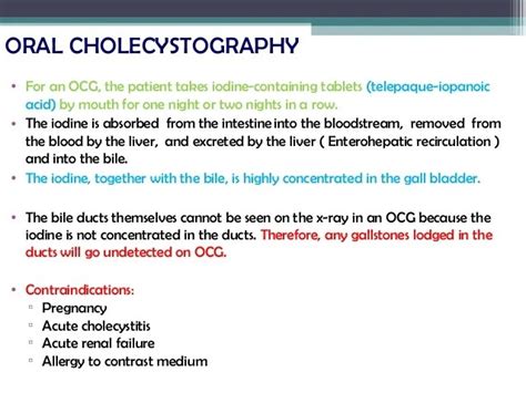 Mercedes Benz Sign In Gall Bladder Stone Cholelithiasis Refers To The