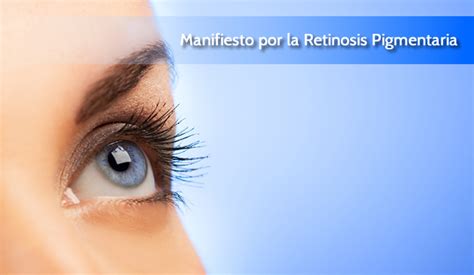 Manifiesto Por La Retinosis Pigmentaria Retina CV