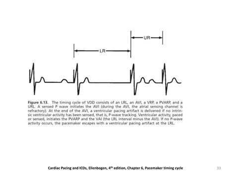 Evaluation And Management Of Pacemaker Malfunction Ppt