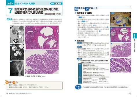 病理像＋内視鏡・ct・mriで一目でわかる！ 臨床医が知っておきたい消化器病理の見かたのコツ 羊土社