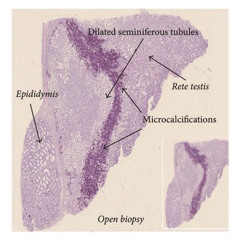 Microscopic Section Of Testicular Tissue A A 30 × 8 Mm Area With