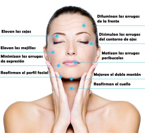 Hilos Tensores Lifting Facial Sin Cirugia Gamaclinic Tratamientos