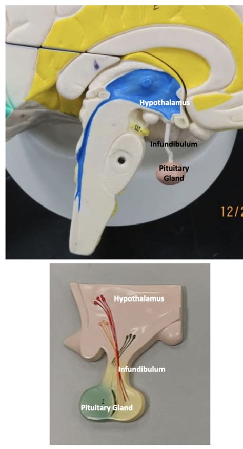 Hypothalamus Diagram Quizlet